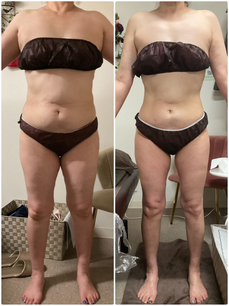 足痩せ 美脚 エステ したい ブリアント ヒートマット 